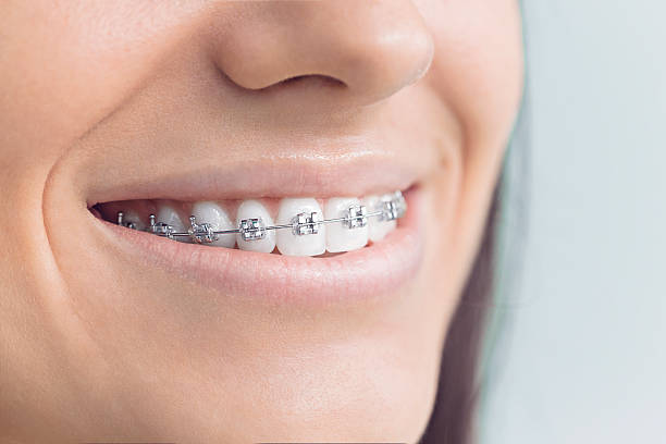 Best Wisdom Tooth Removal  in Mill Creek East, WA